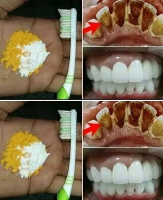 Can This Homemade Tooth Powder Really Remove Tartar? What You Should Know 779842587_122141834415013777_5769889798024388702_n